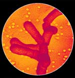  Bifidobacterium animalis 